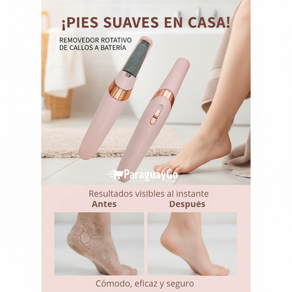 Removedor de callos para pies
